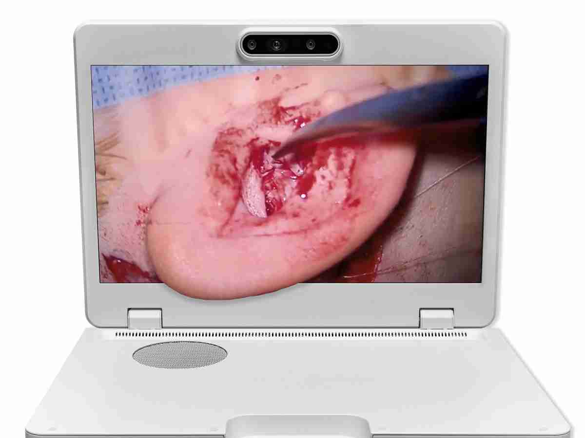 达擎之＂Heads-up 3D显微手术显示系统＂，，整合4K裸眼3D显示及眼球追踪系统，，，具备快速追踪人眼移动位置功能，，，减轻医师长时间维持固定姿势的负担，，让医师能有更宽广清晰的3D立体视野及更舒适的姿势来执行手术。。